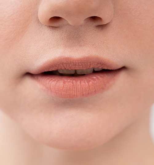 gabys-electrolysis-packages-upper-lips