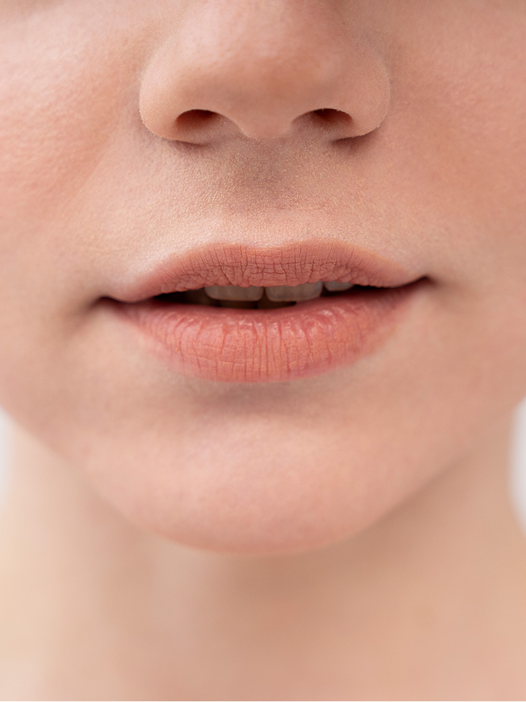 gabys-electrolysis-services-treatments-Upper-Lip-cover